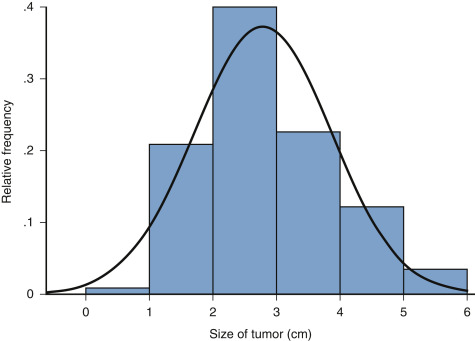 Relative Frequency Distribution